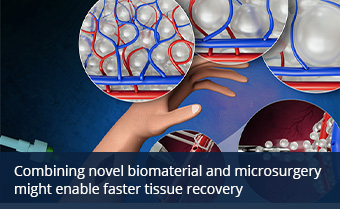 illustration depicting the process of combining biomaterial during microsurgery