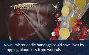 Novel microneedle bandage could save lives by stopping blood loss from wounds